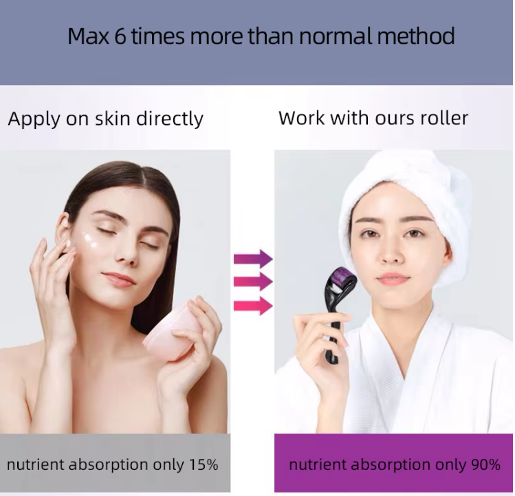 540 Microneedle Derma Roller – Skin Care & Acne Scar Treatment