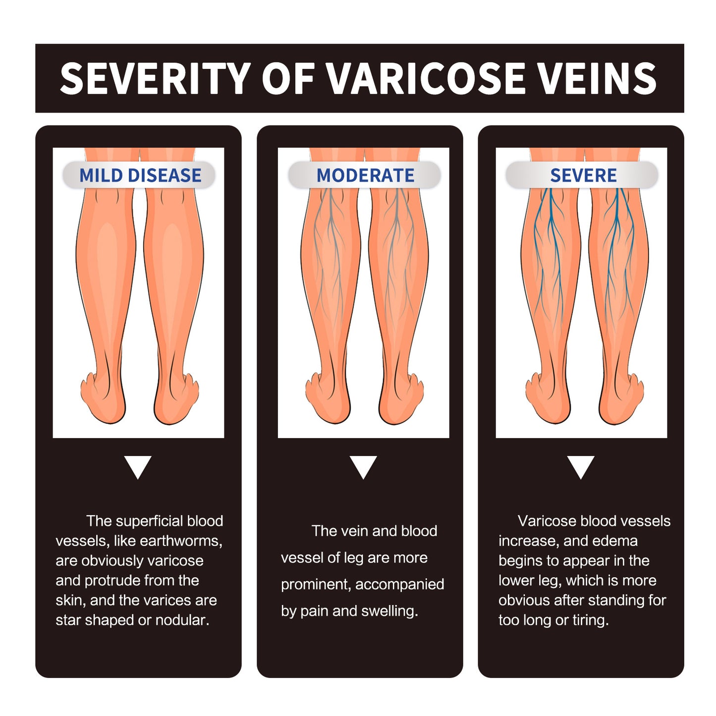 Chamomile Leg Essential Oil Care Leg Skin Relieve Discomfort Massage Essential Oil