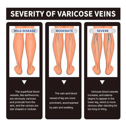 Chamomile Leg Essential Oil Care Leg Skin Relieve Discomfort Massage Essential Oil