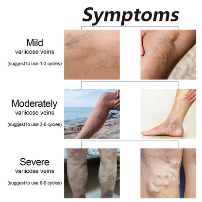 Chamomile Leg Essential Oil Care Leg Skin Relieve Discomfort Massage Essential Oil